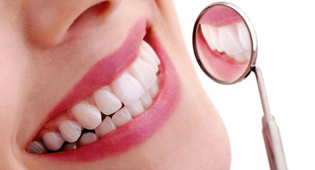 5 Tips Memutihkan Gigi yang Murah dan Aman