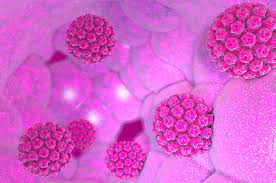 Waspada Virus Papiloma: Penyebab, Gejala, dan Cara Mencegahnya